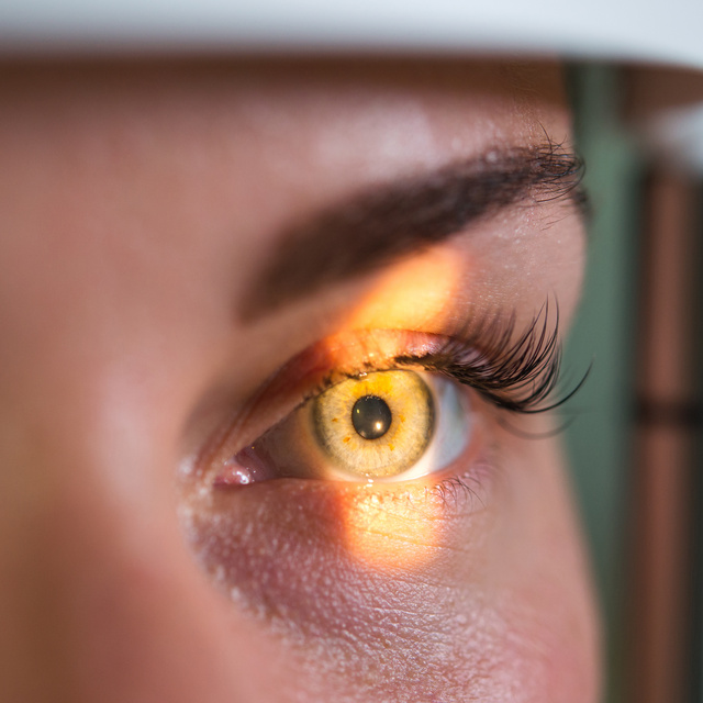 Vision Therapy in Shops Of Sunnybrook